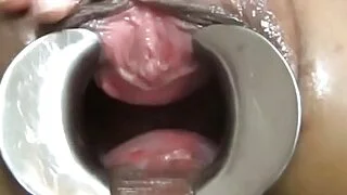亚洲窥阴器